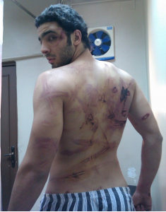 Ramy Essam tortured